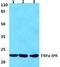 TNF Alpha Induced Protein 8 antibody, PA5-75573, Invitrogen Antibodies, Western Blot image 