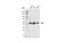 LYN Proto-Oncogene, Src Family Tyrosine Kinase antibody, 2796P, Cell Signaling Technology, Western Blot image 