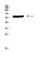 Cytochrome P450 Family 26 Subfamily B Member 1 antibody, A02691, Boster Biological Technology, Western Blot image 