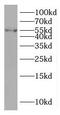 TGF-Beta Activated Kinase 1 (MAP3K7) Binding Protein 1 antibody, FNab08464, FineTest, Western Blot image 