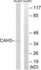 Carbonic Anhydrase 3 antibody, LS-C119812, Lifespan Biosciences, Western Blot image 