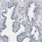 Solute Carrier Family 45 Member 3 antibody, NBP1-89630, Novus Biologicals, Immunohistochemistry frozen image 