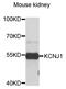 Potassium Voltage-Gated Channel Subfamily J Member 1 antibody, STJ111290, St John