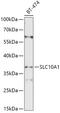 Sodium/taurocholate cotransporting polypeptide antibody, 13-526, ProSci, Western Blot image 