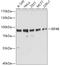 Eukaryotic Translation Initiation Factor 4B antibody, 19-645, ProSci, Western Blot image 