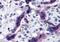 Tau Tubulin Kinase 2 antibody, NBP2-41097, Novus Biologicals, Immunohistochemistry paraffin image 