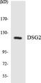 Desmoglein 2 antibody, LS-C291897, Lifespan Biosciences, Western Blot image 