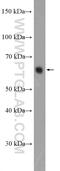 Kinesin Family Member C1 antibody, 20790-1-AP, Proteintech Group, Western Blot image 