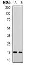 Stathmin 1 antibody, orb339192, Biorbyt, Western Blot image 