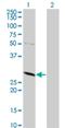 Thiopurine S-Methyltransferase antibody, H00007172-M02, Novus Biologicals, Western Blot image 