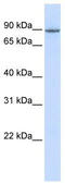 OTU Deubiquitinase 7B antibody, TA337241, Origene, Western Blot image 