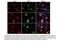 FUS RNA Binding Protein antibody, 60160-1-Ig, Proteintech Group, Immunofluorescence image 