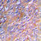 Collagen Type III Alpha 1 Chain antibody, LS-C352027, Lifespan Biosciences, Immunohistochemistry paraffin image 
