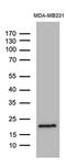 SPANX Family Member B1 antibody, M13843, Boster Biological Technology, Western Blot image 