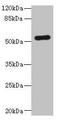 Lactate Dehydrogenase D antibody, A65962-100, Epigentek, Western Blot image 