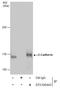 Cadherin 1 antibody, GTX100443, GeneTex, Immunoprecipitation image 