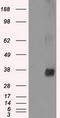 NIMA Related Kinase 6 antibody, GTX84058, GeneTex, Western Blot image 