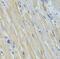 NME/NM23 Nucleoside Diphosphate Kinase 1 antibody, FNab05762, FineTest, Immunohistochemistry paraffin image 