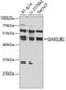 SH3 Domain Containing GRB2 Like, Endophilin B2 antibody, 23-049, ProSci, Western Blot image 