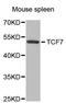 Transcription Factor 7 antibody, STJ25794, St John