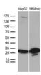 Dehydrogenase/Reductase 4 Like 2 antibody, MA5-27281, Invitrogen Antibodies, Western Blot image 