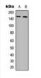 Colony Stimulating Factor 1 Receptor antibody, orb393255, Biorbyt, Western Blot image 