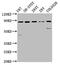 Solute Carrier Family 26 Member 4 antibody, CSB-PA021527LA01HU, Cusabio, Western Blot image 