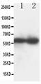 DNA Nucleotidylexotransferase antibody, PA5-79163, Invitrogen Antibodies, Western Blot image 