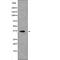 MCL1 Apoptosis Regulator, BCL2 Family Member antibody, abx216753, Abbexa, Western Blot image 