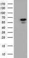 Adenylate Kinase 5 antibody, LS-C115584, Lifespan Biosciences, Western Blot image 