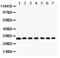 Galectin 3 antibody, PA5-79596, Invitrogen Antibodies, Western Blot image 