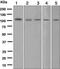 Mindbomb E3 Ubiquitin Protein Ligase 1 antibody, ab124929, Abcam, Western Blot image 