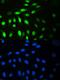 Minichromosome Maintenance Complex Component 7 antibody, PB9261, Boster Biological Technology, Immunofluorescence image 