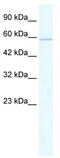 Zinc Finger Protein 276 antibody, TA341469, Origene, Western Blot image 