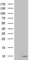 Protein S100-A6 antibody, LS-C339128, Lifespan Biosciences, Western Blot image 