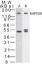 Regulatory Associated Protein Of MTOR Complex 1 antibody, PA1-41269, Invitrogen Antibodies, Western Blot image 