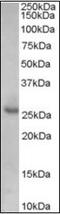 Cyclin Dependent Kinase Inhibitor 1B antibody, orb89301, Biorbyt, Western Blot image 