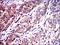Neurofilament Light antibody, MA5-17135, Invitrogen Antibodies, Immunohistochemistry frozen image 