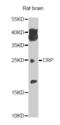 C-Reactive Protein antibody, orb129574, Biorbyt, Western Blot image 