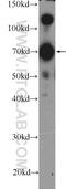 Kinesin Family Member 5C antibody, 25897-1-AP, Proteintech Group, Western Blot image 
