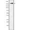 Neurofibromin 1 antibody, abx217147, Abbexa, Western Blot image 