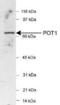 Protection Of Telomeres 1 antibody, PA1-16830, Invitrogen Antibodies, Western Blot image 