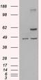 TNF Receptor Associated Factor 2 antibody, EB07171, Everest Biotech, Western Blot image 