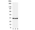 TNF Receptor Superfamily Member 4 antibody, R31252, NSJ Bioreagents, Western Blot image 