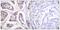 Vinculin antibody, A30448, Boster Biological Technology, Immunohistochemistry paraffin image 