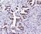 Translocated Promoter Region, Nuclear Basket Protein antibody, A00695-1, Boster Biological Technology, Immunohistochemistry frozen image 