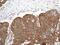 Mitogen-Activated Protein Kinase Kinase 1 antibody, ab96379, Abcam, Immunohistochemistry paraffin image 