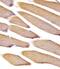 Vinculin antibody, M01207-2, Boster Biological Technology, Immunohistochemistry paraffin image 