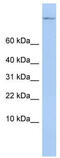 TSC22 Domain Family Member 1 antibody, TA337294, Origene, Western Blot image 