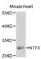 Neurotrophin 3 antibody, STJ24829, St John